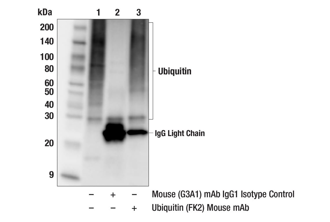 Immunoprecipitation Image 1: Ubiquitin (FK2) Mouse Monoclonal Antibody