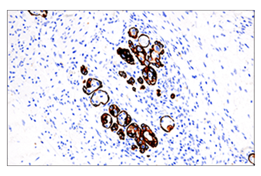 Immunohistochemistry Image 2: Keratin 5 (E2T4B) Rabbit Monoclonal Antibody (BSA and Azide Free)