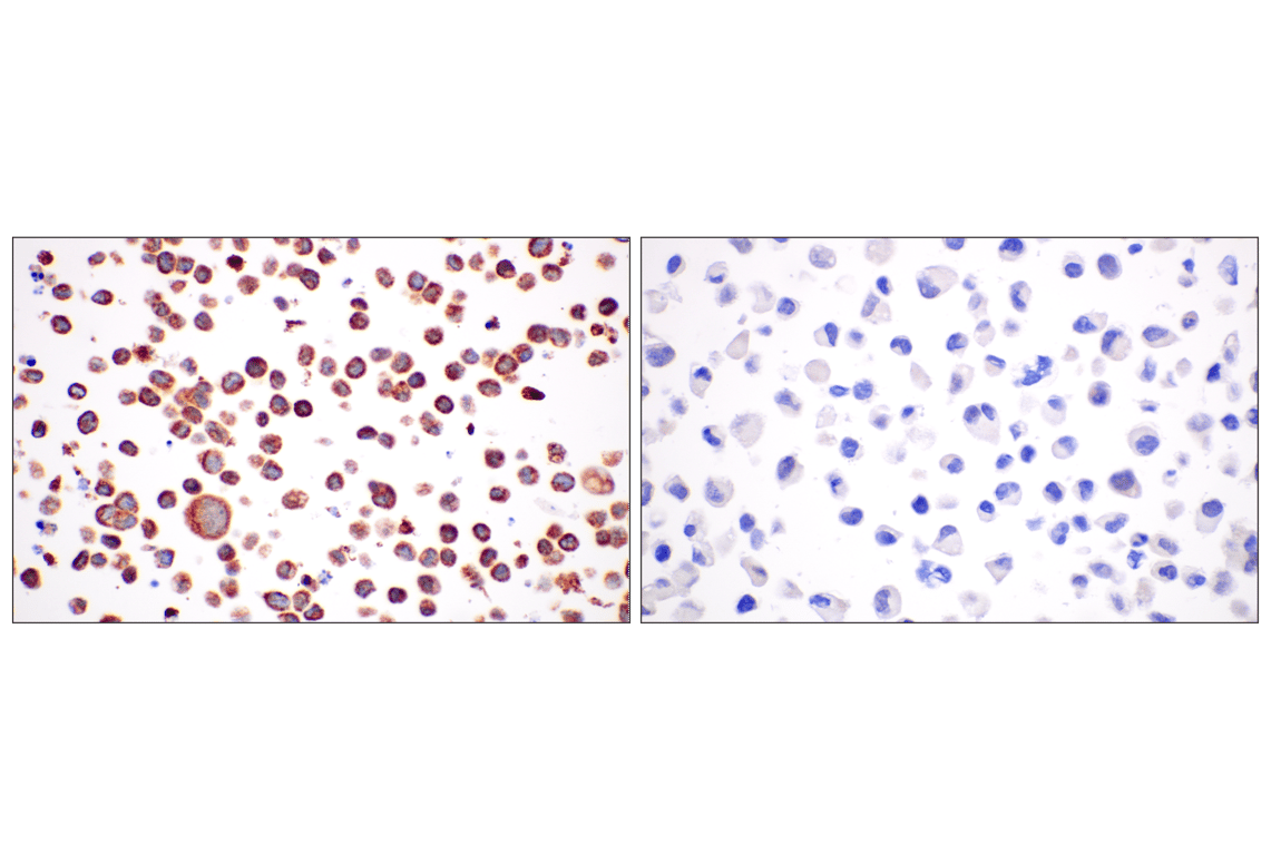 Immunohistochemistry Image 9: CPT1A (E3Y1V) Rabbit Monoclonal Antibody