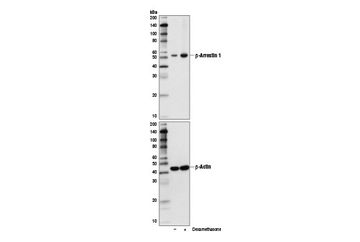 Western Blotting Image 2: beta-Arrestin 1 (D7Z3W) Rabbit Monoclonal Antibody