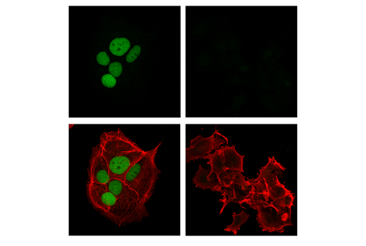 Immunofluorescence Image 1: ATF-3 (E9J4N) Rabbit Monoclonal Antibody