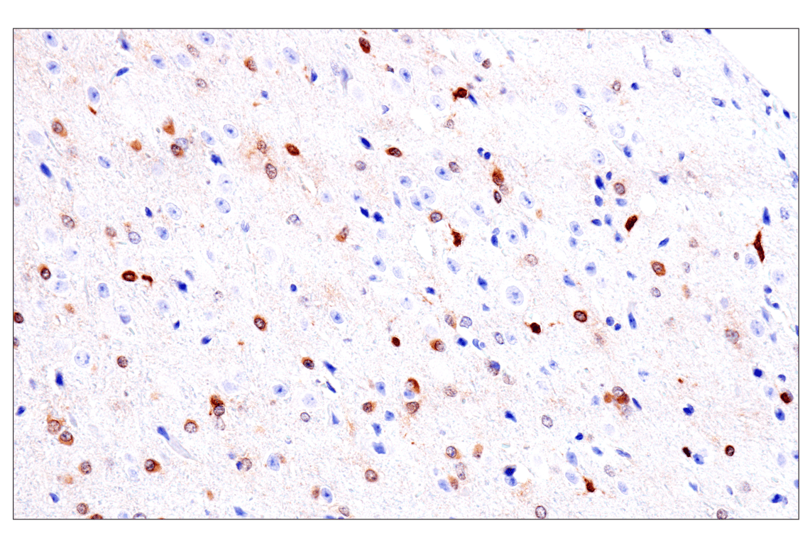 Immunohistochemistry Image 2: Olig1 (E3T6D) Rabbit Monoclonal Antibody