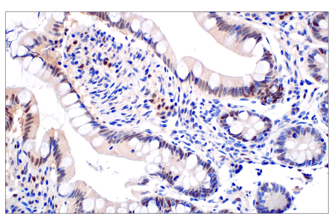 Immunohistochemistry Image 7: ID1 (F2M1J) Rabbit Monoclonal Antibody (BSA and Azide Free)