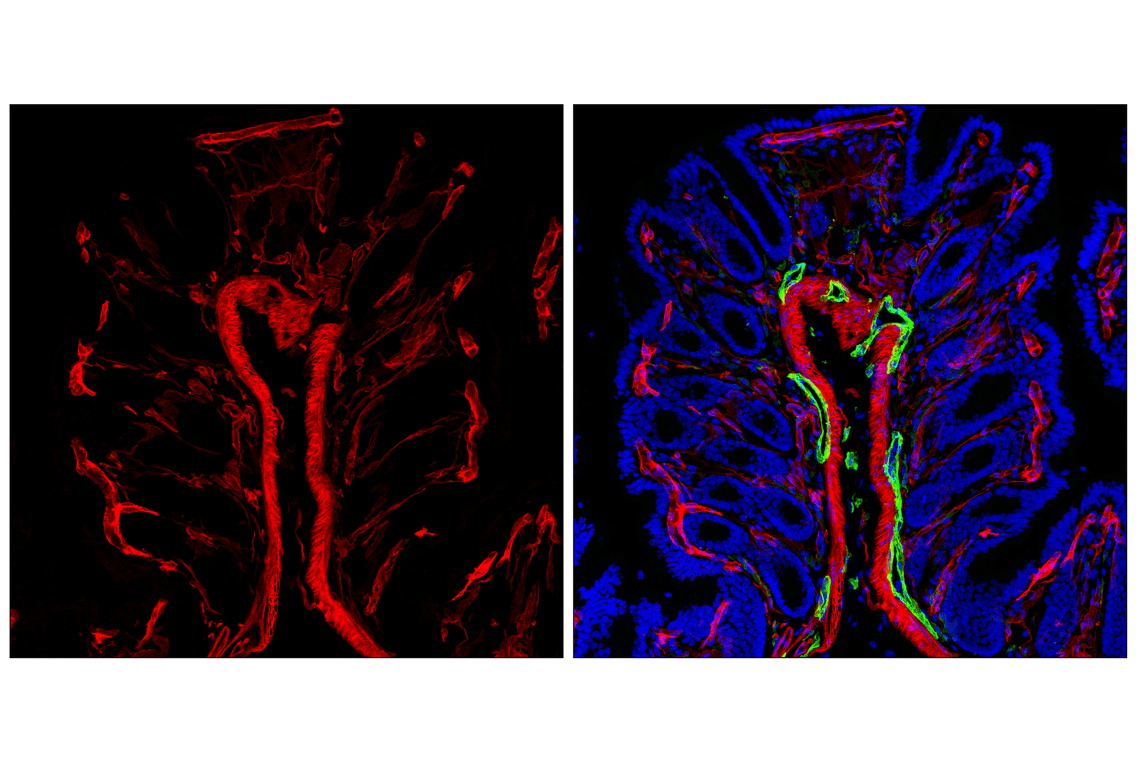 undefined Image 89: Pericyte Antibody Sampler Kit