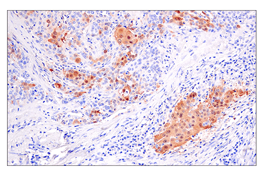 Immunohistochemistry Image 1: S100A7 (E7X2C) Rabbit Monoclonal Antibody (BSA and Azide Free)