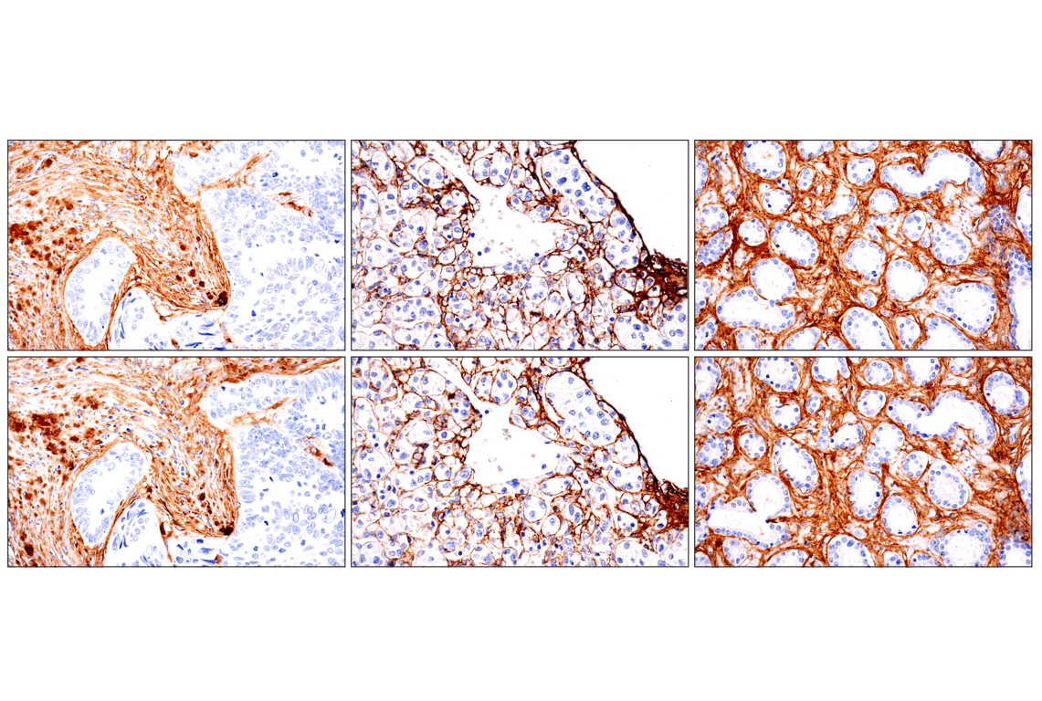 Immunohistochemistry Image 11: COL1A1 (E8F4L) Rabbit Monoclonal Antibody