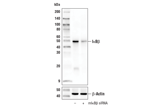 Western Blotting Image 2: IkappaB beta (D1T3Z) Rabbit Monoclonal Antibody