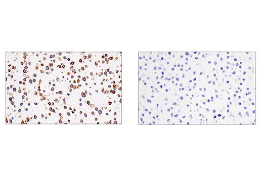Immunohistochemistry Image 6: CRACC/SLAMF7/CD319 (E5C4M) Rabbit Monoclonal Antibody (BSA and Azide Free)