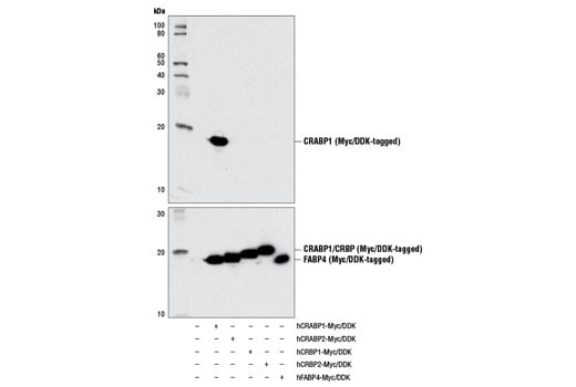 Western Blotting Image 2: CRABP1 (D7F9T) Rabbit Monoclonal Antibody