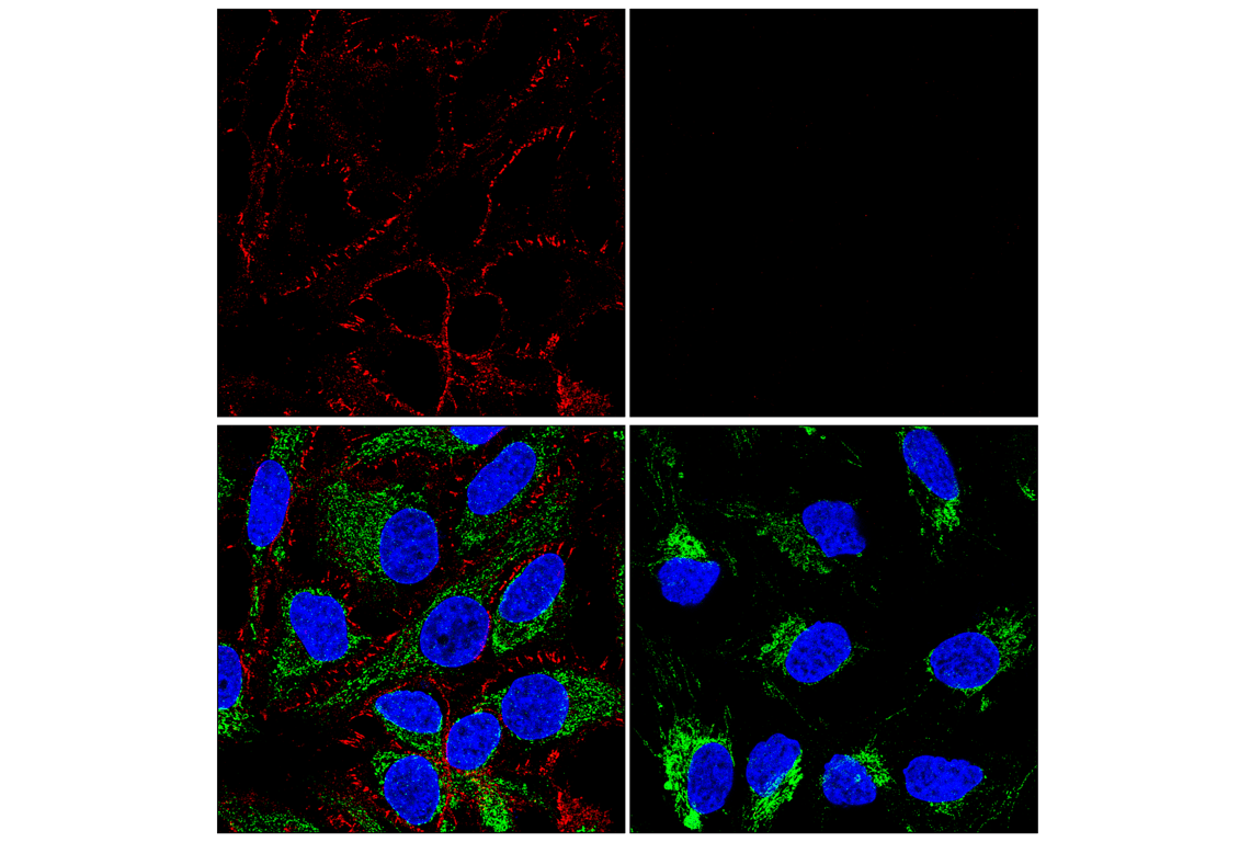 Immunofluorescence Image 1: beta-Catenin (D10A8) Rabbit Monoclonal Antibody (Alexa Fluor<sup>®</sup> 647 Conjugate)