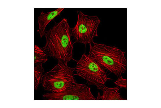 Immunofluorescence Image 1: Tri-Methyl-Histone H3 (Lys4) (C42D8) Rabbit Monoclonal Antibody