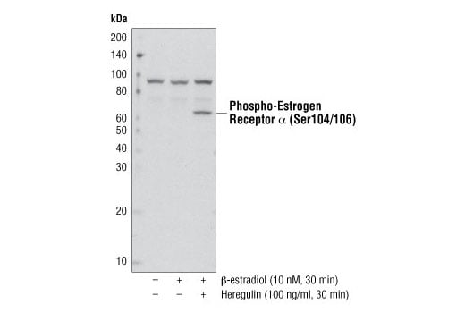 Western Blotting Image 2: Phospho-Estrogen Receptor alpha (Ser104/106) Antibody