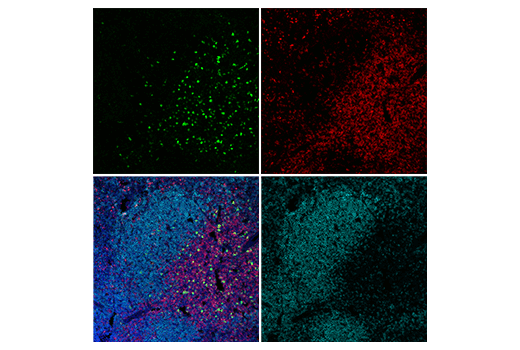Immunofluorescence Image 2: IL-2R alpha/CD25 (E9W2J) Rabbit Monoclonal Antibody