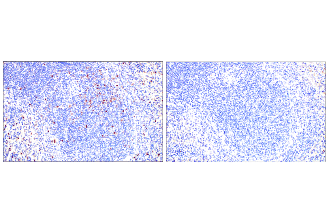 Immunohistochemistry Image 13: T-bet/TBX21 (E4I2K) Rabbit Monoclonal Antibody (BSA and Azide Free)