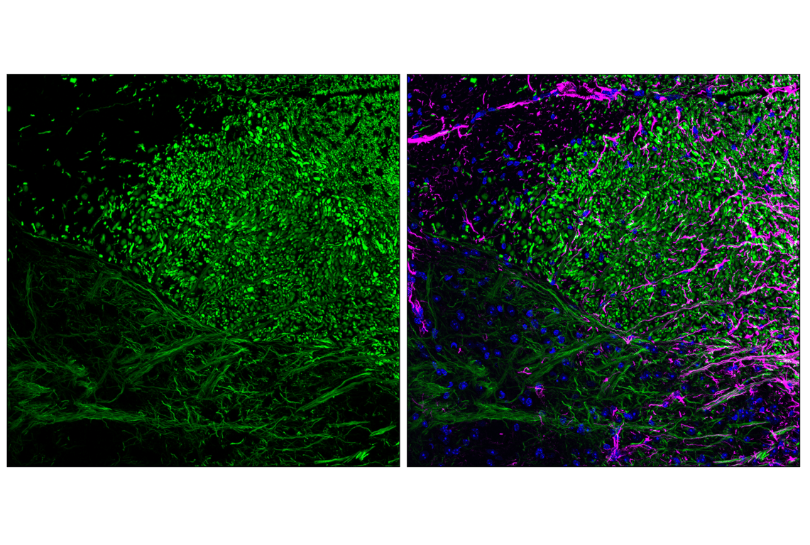 Immunofluorescence Image 3: Peripherin (F3J1R) Rabbit Monoclonal Antibody