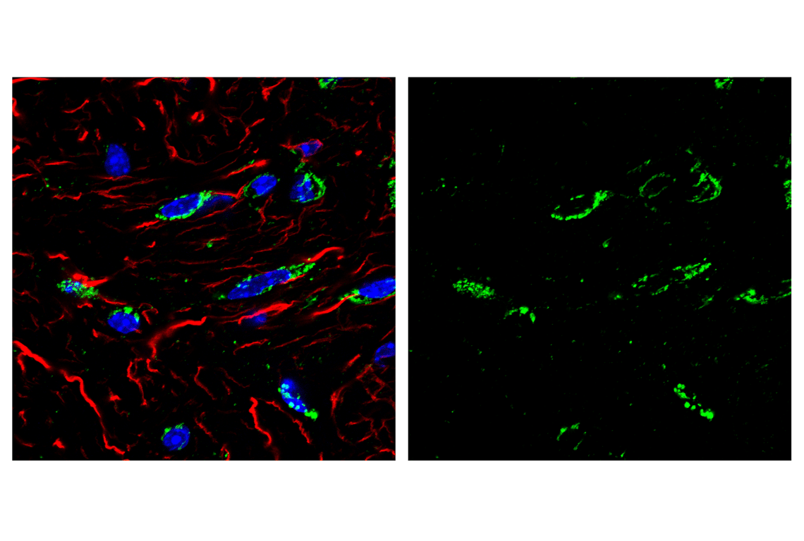 Immunofluorescence Image 1: Smac/Diablo (D5S3R) Rabbit Monoclonal Antibody