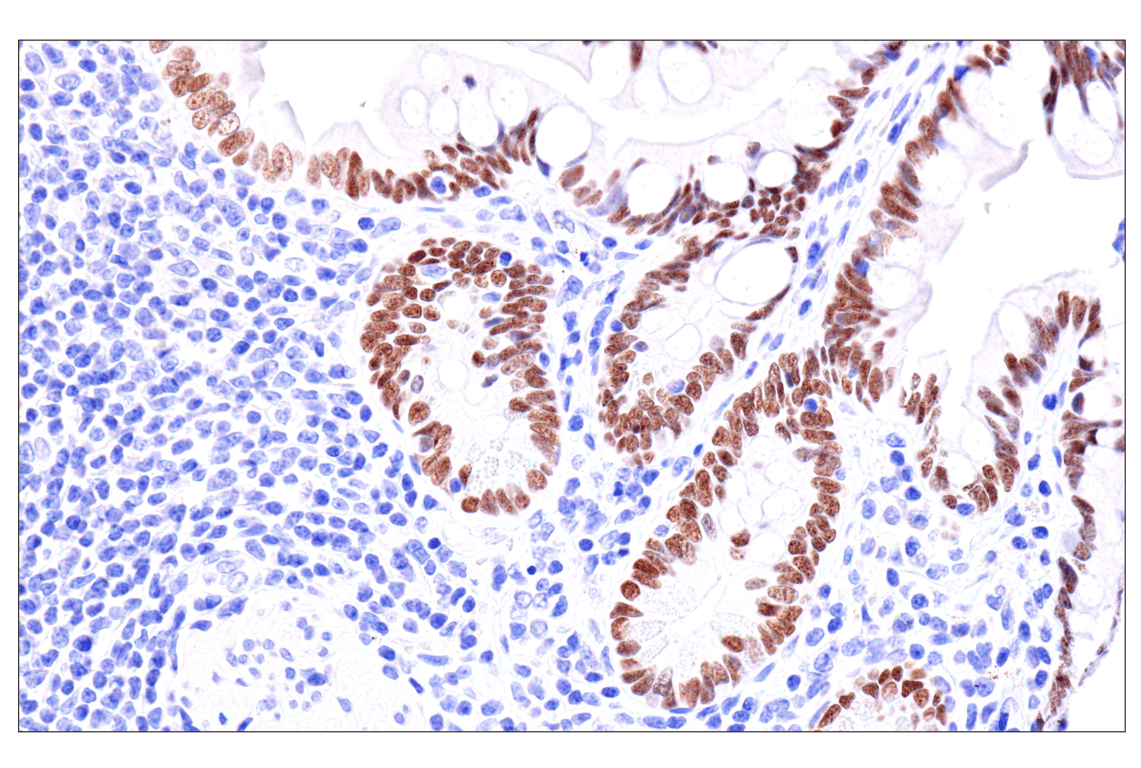 Immunohistochemistry Image 9: GATA-6 (D61E4) XP<sup>®</sup> Rabbit mAb (BSA and Azide Free)
