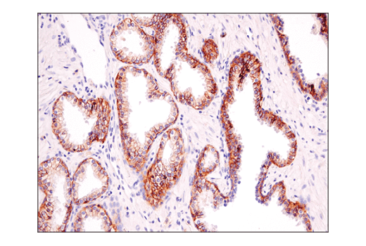 Immunohistochemistry Image 7: ASCT2 (D7C12) Rabbit Monoclonal Antibody