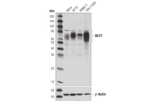 Western Blotting Image 1: MITF (D3B4T) Rabbit mAb