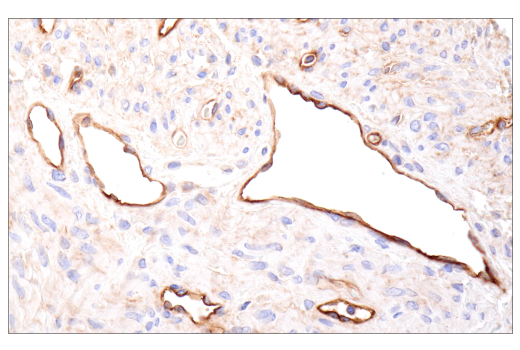Immunohistochemistry Image 9: CD109 (E4I2V) Rabbit Monoclonal Antibody