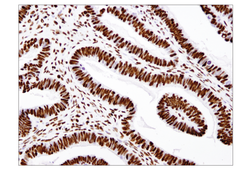 Immunohistochemistry Image 1: Acetyl-Histone H3 (Lys18) (D8Z5H) Rabbit Monoclonal Antibody