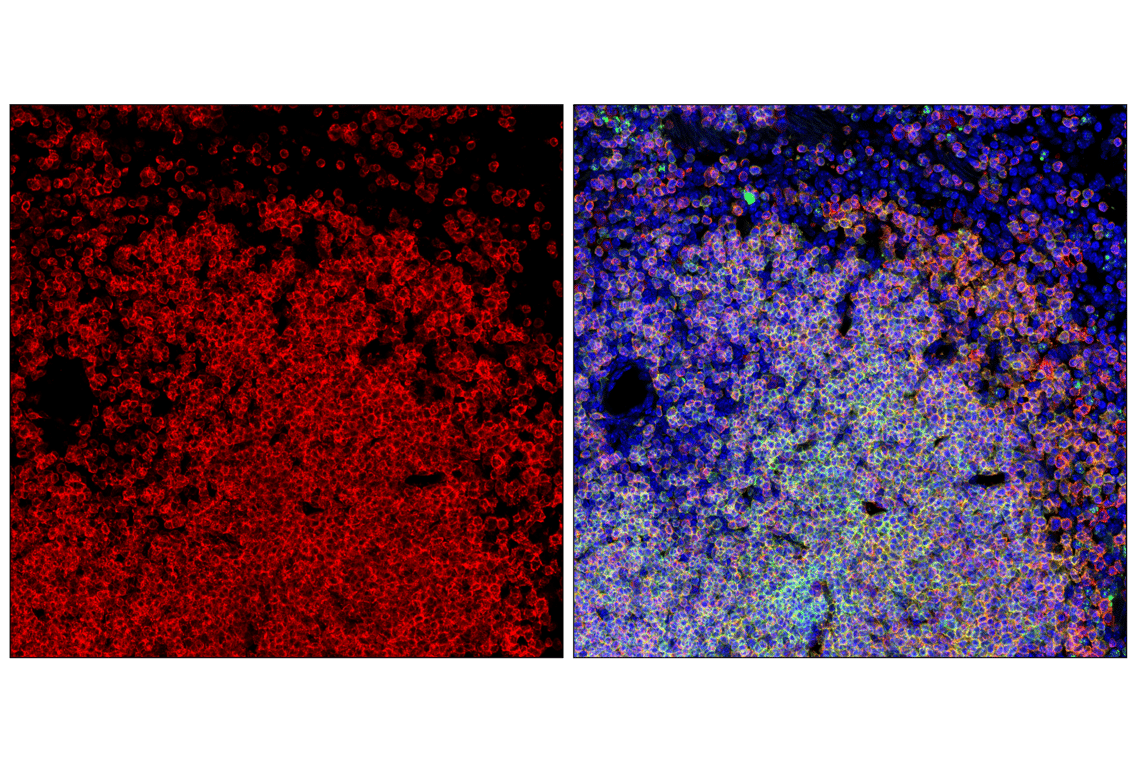 Immunofluorescence Image 1: CD79A (F3Z1H) Rabbit Monoclonal Antibody