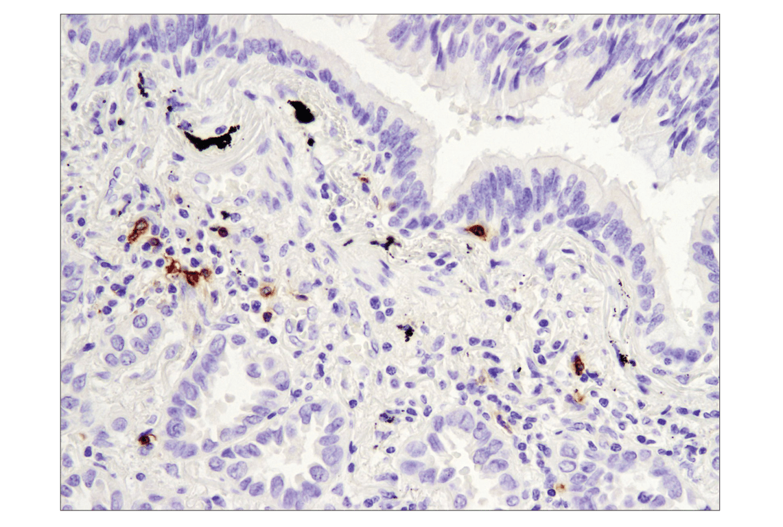 Immunohistochemistry Image 3: OX40 (E9U7O) Rabbit Monoclonal Antibody (BSA and Azide Free)