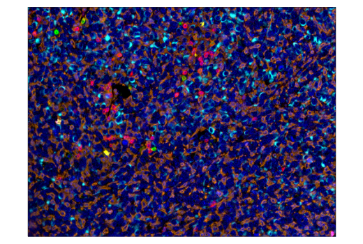 Immunohistochemistry Image 6: PD-1 (Intracellular Domain) (D7D5W) Rabbit Monoclonal Antibody (BSA and Azide Free)