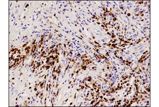 Immunohistochemistry Image 2: CD79A (D1X5C) Rabbit Monoclonal Antibody