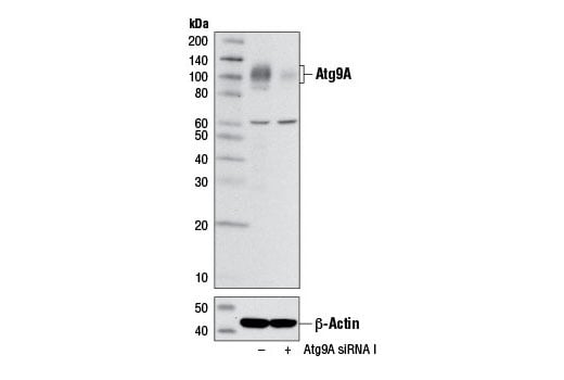 Western Blotting Image 2: Atg9A (D4O9D) Rabbit Monoclonal Antibody