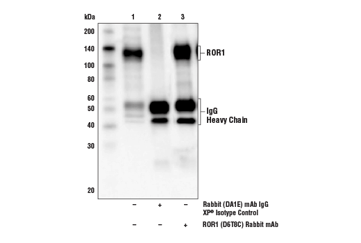Immunoprecipitation Image 1: ROR1 (D6T8C) Rabbit Monoclonal Antibody