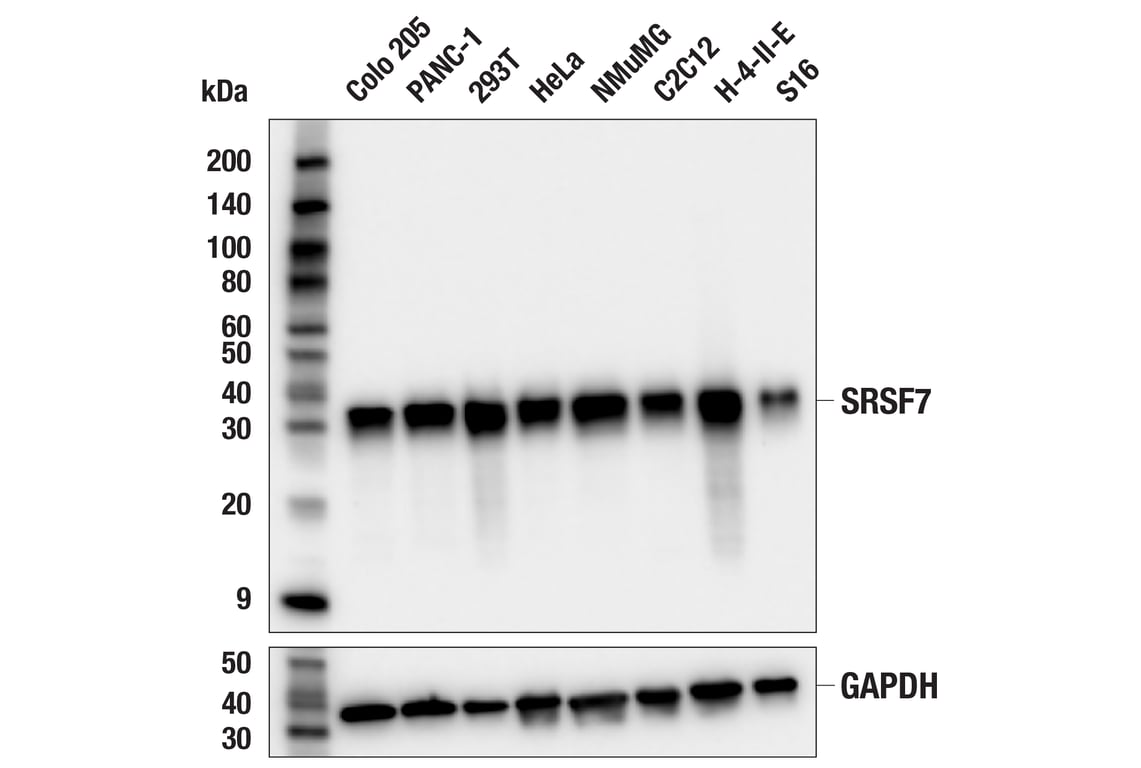Western Blotting Image 2: SRSF7 (F9G2P) Rabbit Monoclonal Antibody