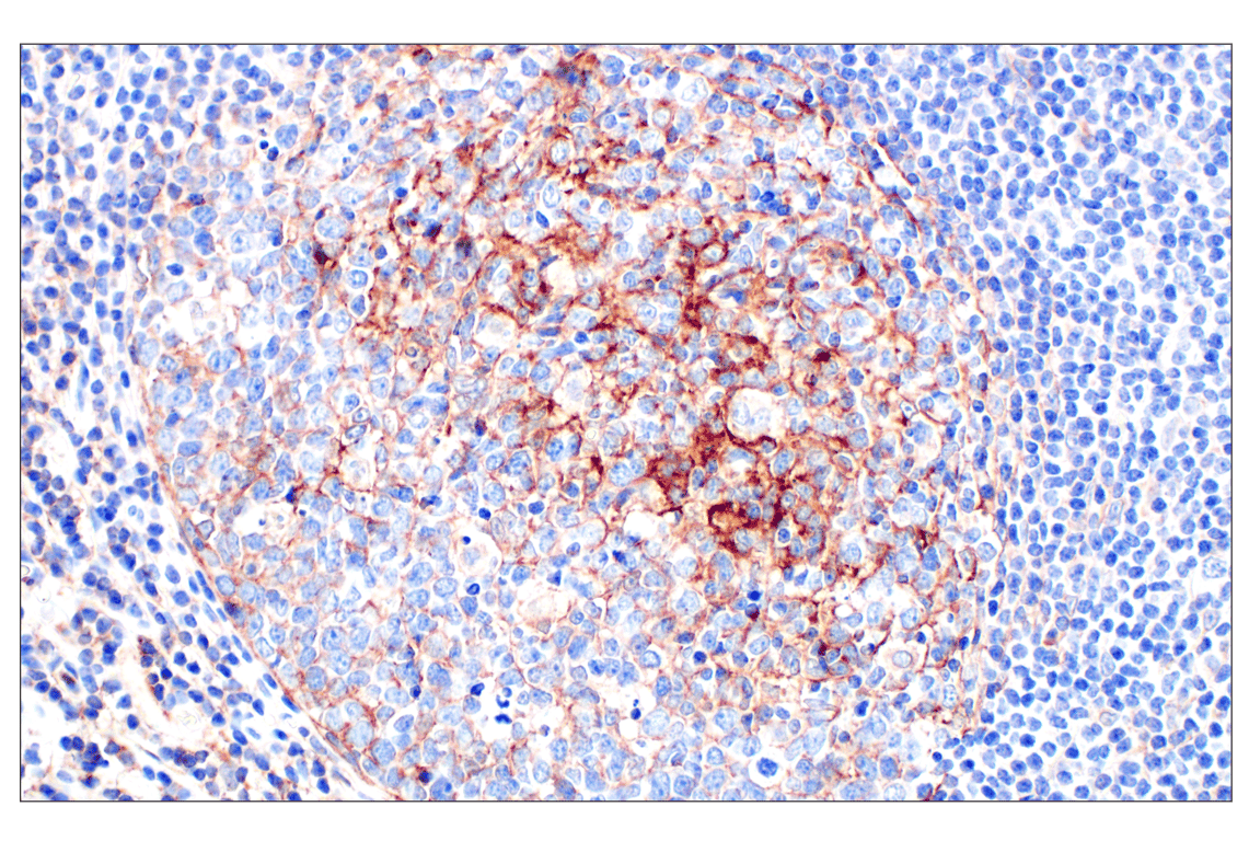 Immunohistochemistry Image 4: CR1/CD35 (E8B1Z) Rabbit Monoclonal Antibody