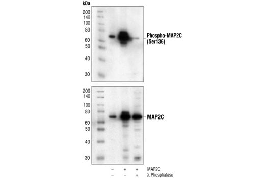 Western Blotting Image 2: Phospho-MAP2 (Ser136) Antibody