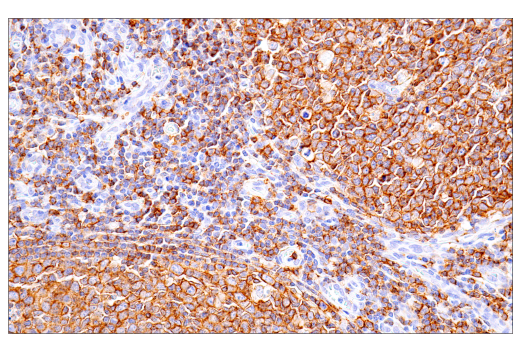 Immunohistochemistry Image 3: CD20 (L26) Mouse Monoclonal Antibody
