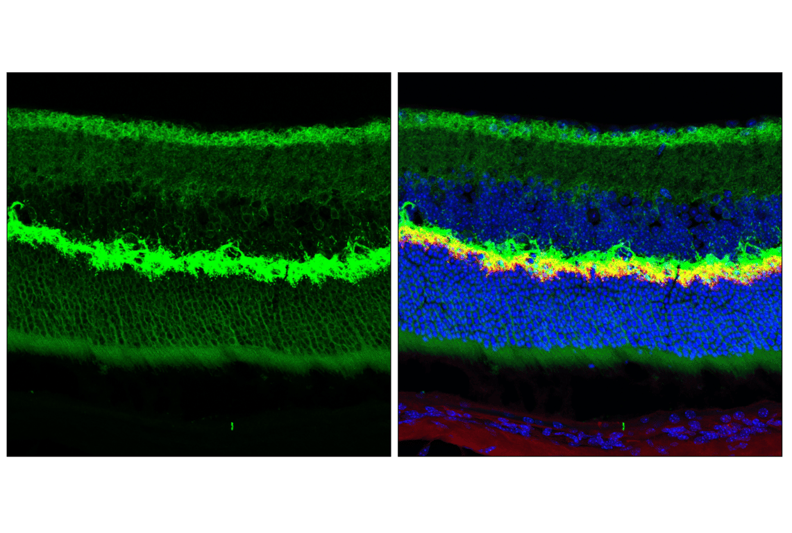 Immunofluorescence Image 3: SNAP25 (F5Z2D) Rabbit Monoclonal Antibody