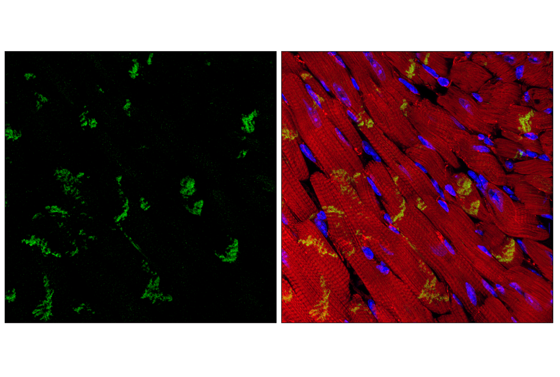 Immunofluorescence Image 1: Desmoplakin (F3J8Y) Rabbit Monoclonal Antibody