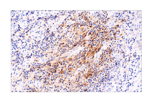 Immunohistochemistry Image 7: CXCL9/MIG (E6Z5W) Rabbit Monoclonal Antibody (BSA and Azide Free)