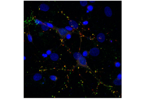 Immunofluorescence Image 1: PSD95 (7E3) Mouse Monoclonal Antibody