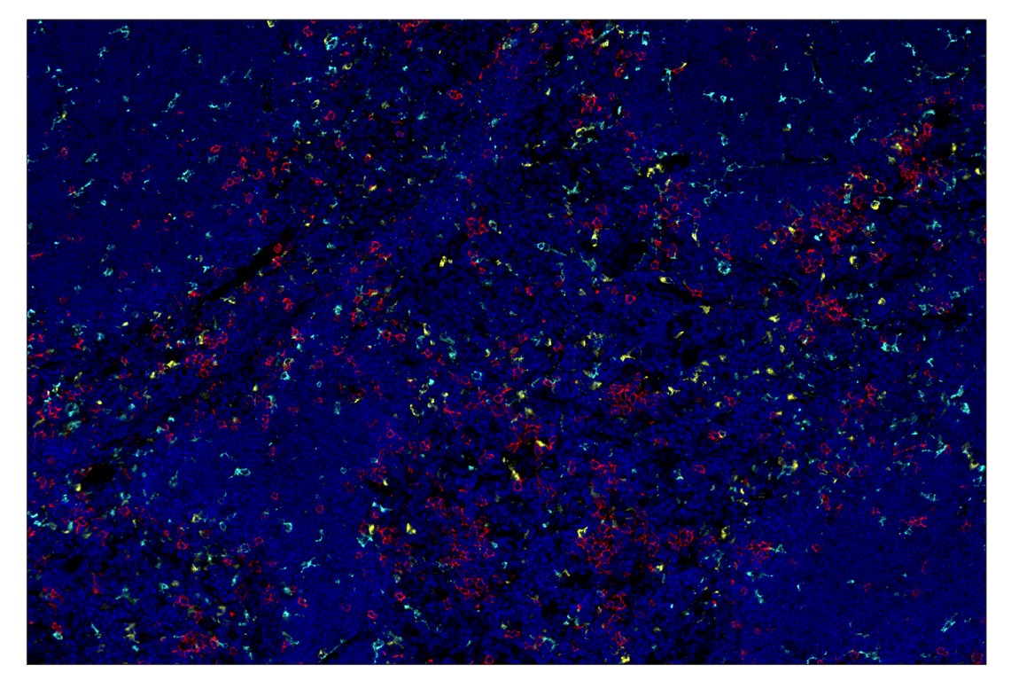 Immunohistochemistry Image 7: CD20 (E3N7O) & CO-0134-594 SignalStar<sup>™</sup> Oligo-Antibody Pair