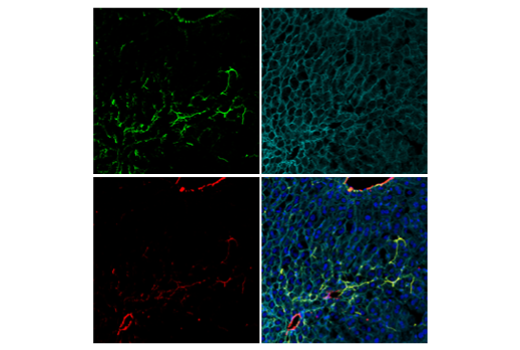 Immunofluorescence Image 2: COL1A1 (E8F4L) Rabbit Monoclonal Antibody (BSA and Azide Free)