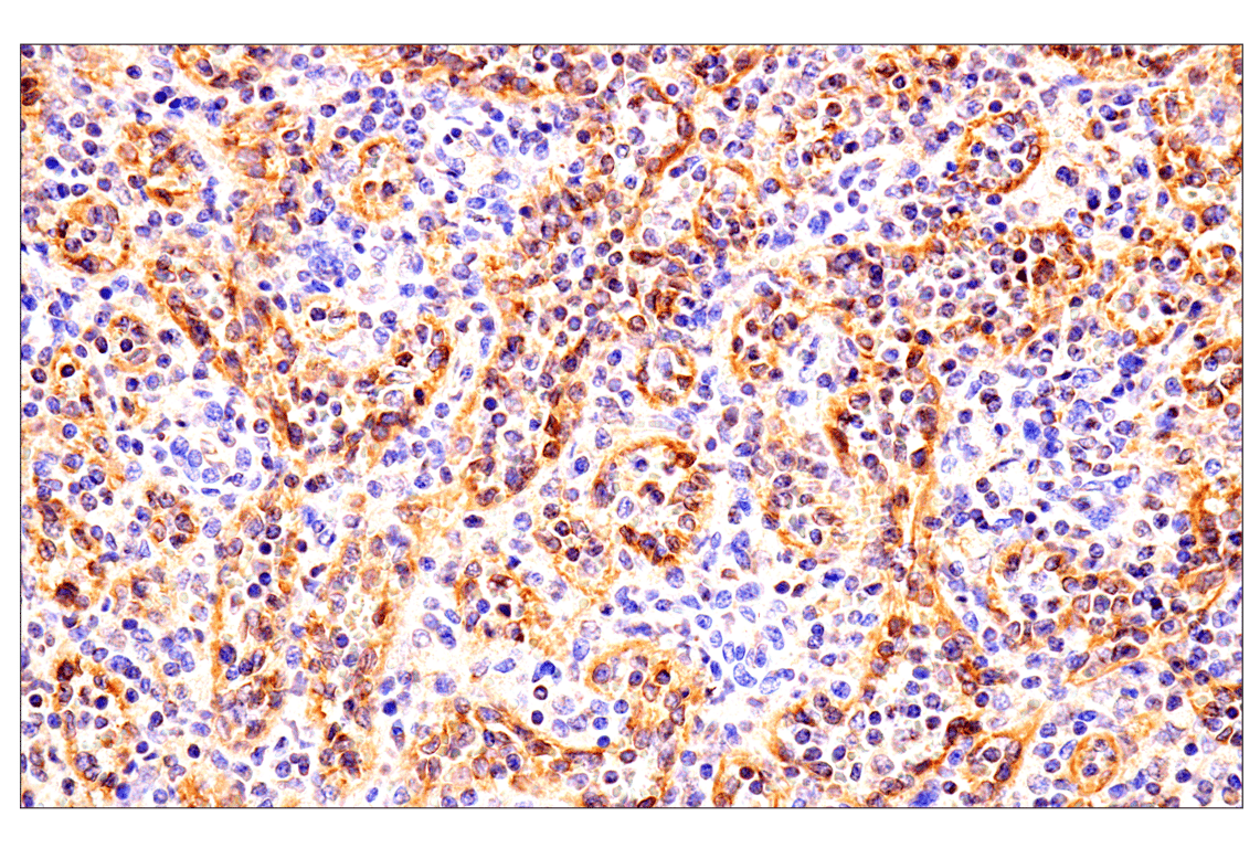 Immunohistochemistry Image 1: HLA-E (MEM-E/02) Mouse Monoclonal Antibody