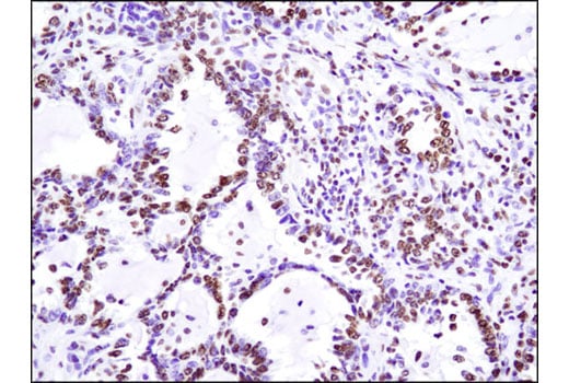 Immunohistochemistry Image 3: Acetyl-Histone H4 (Lys5) (D12B3) Rabbit Monoclonal Antibody