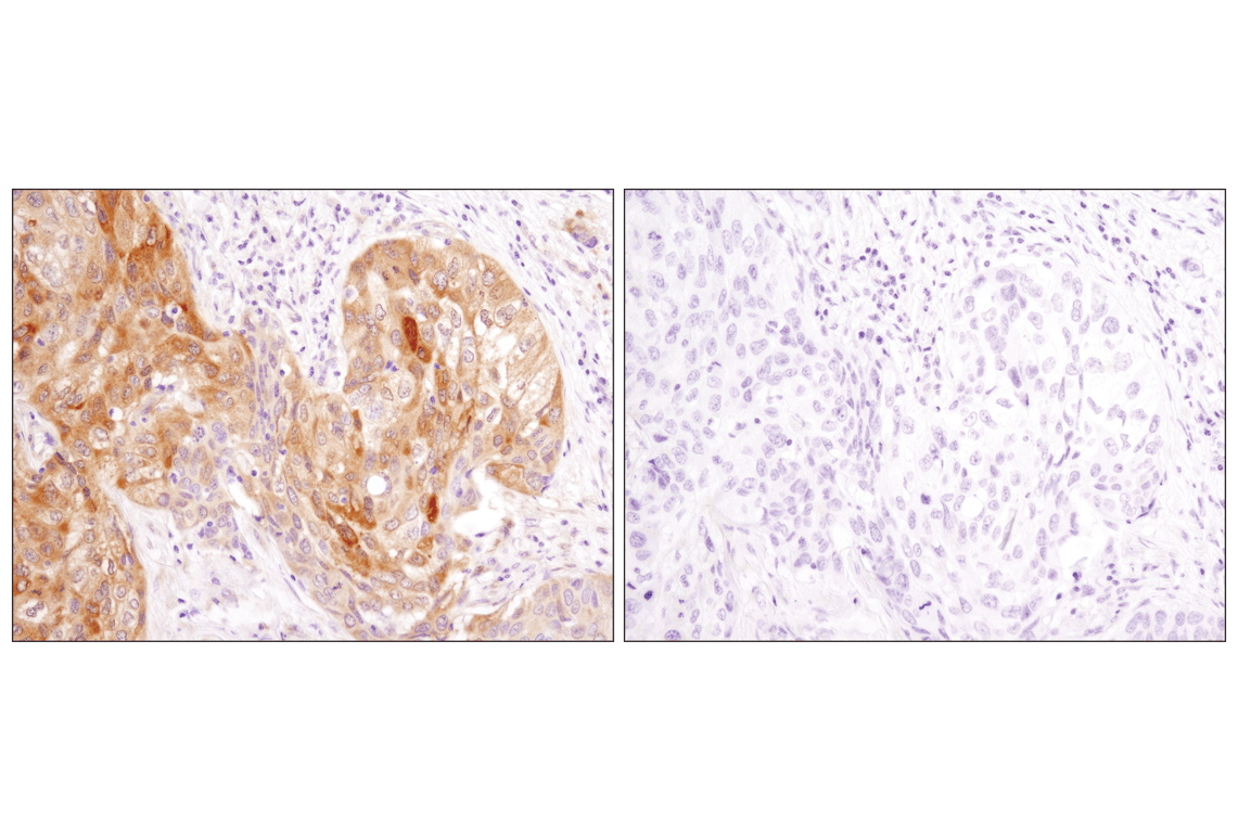 Immunohistochemistry Image 1: LC3A/B (D3U4C) Rabbit Monoclonal Antibody (BSA and Azide Free)