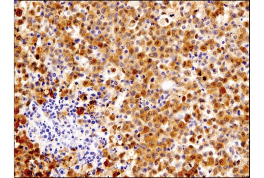 undefined Image 32: Stat Antibody Sampler Kit II