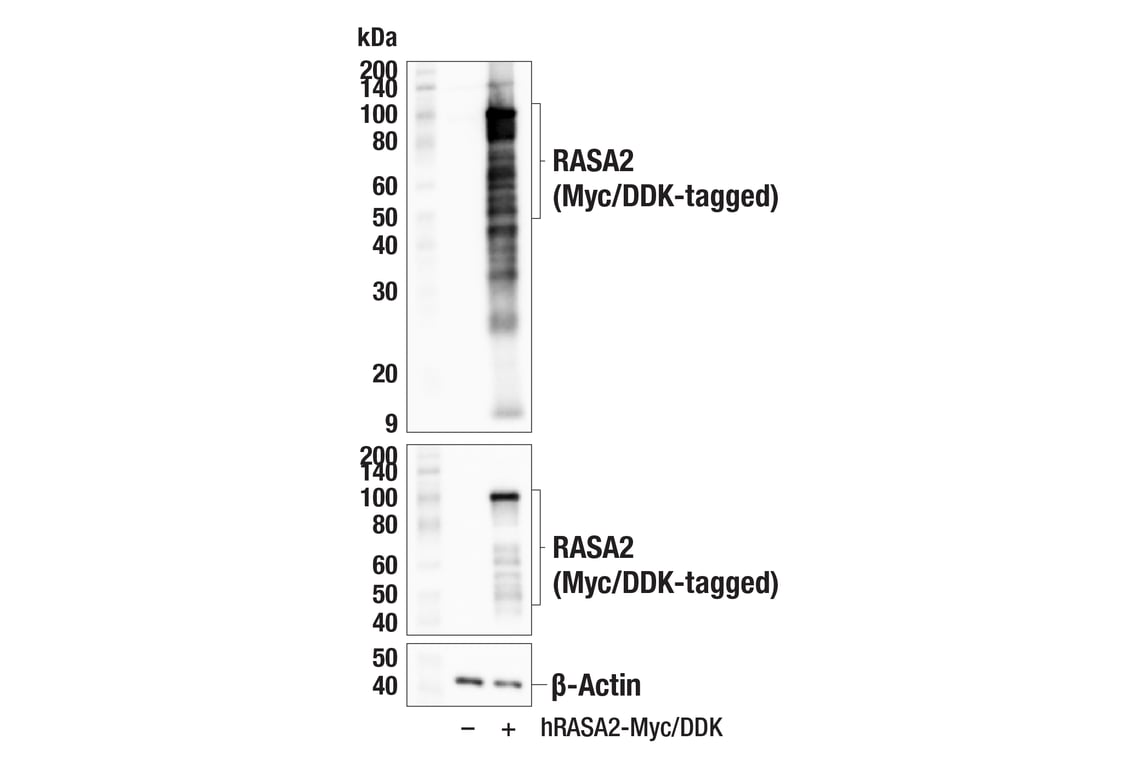 Western Blotting Image 3: RASA2 (F2O1I) Rabbit Monoclonal Antibody