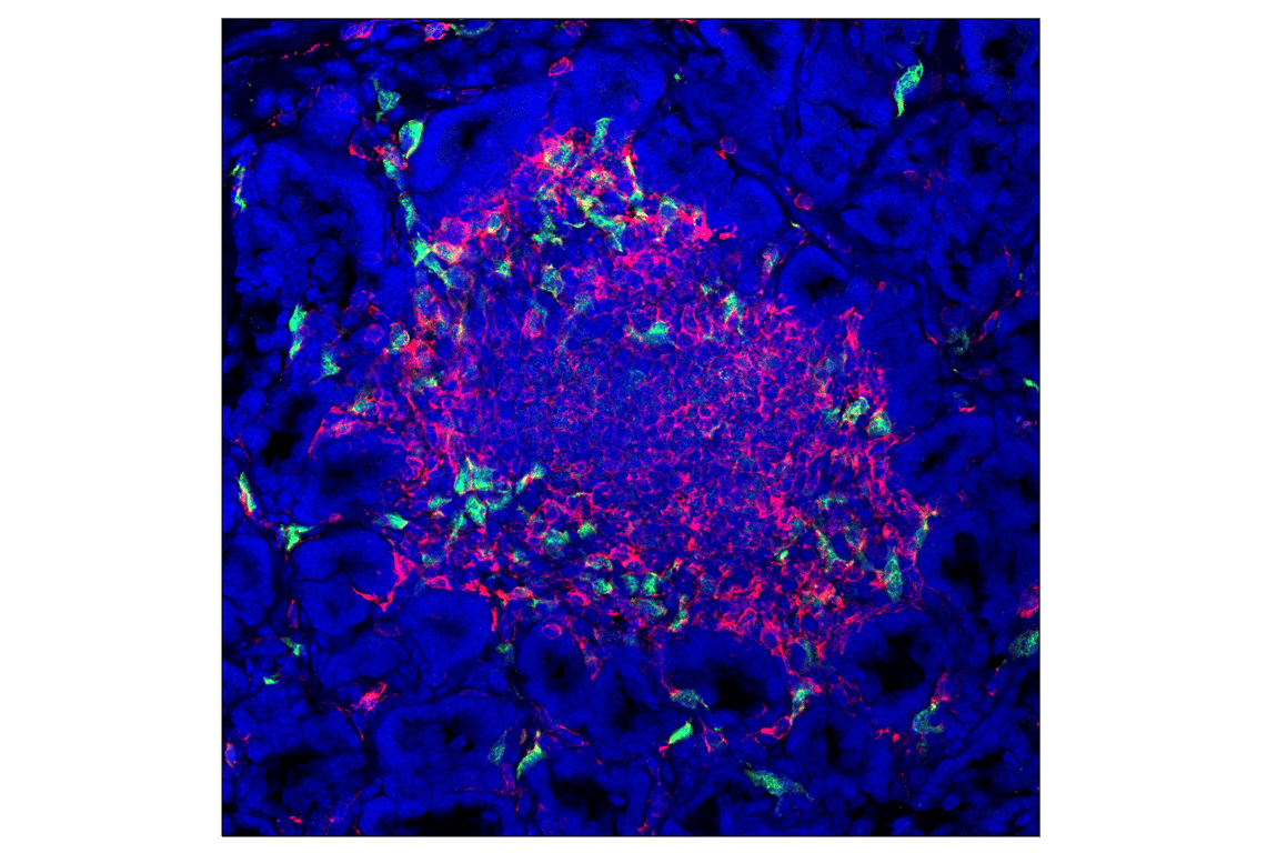 Immunofluorescence Image 1: IRF-5 (E9I4Z) Rabbit Monoclonal Antibody (BSA and Azide Free)