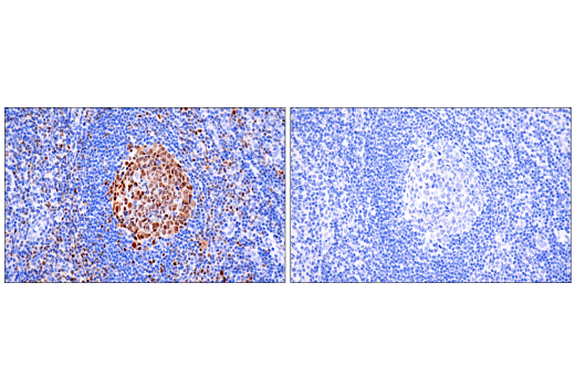 Immunohistochemistry Image 2: Tox/Tox2 (E6I3Q) Rabbit Monoclonal Antibody (BSA and Azide Free)