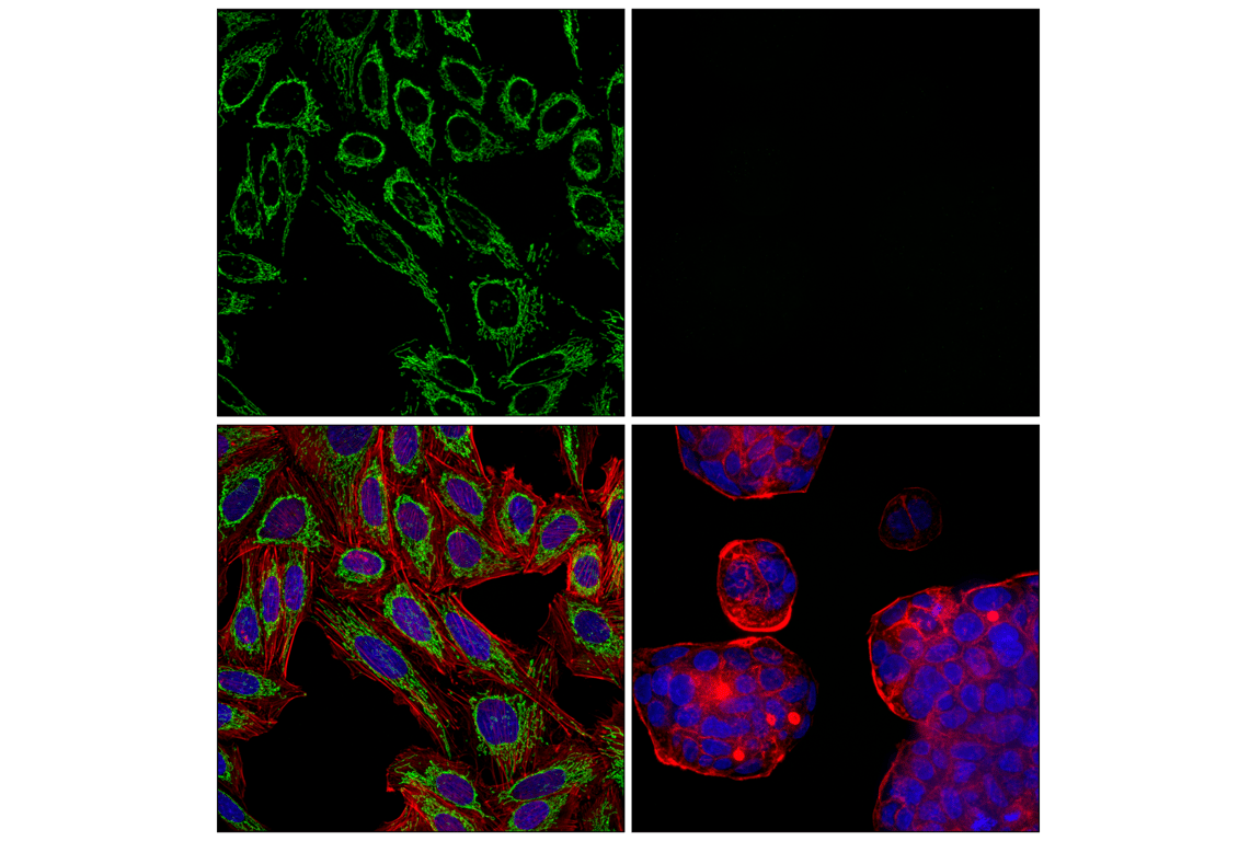 Immunofluorescence Image 1: SCOT1/OXCT1 (F1O1D) Rabbit Monoclonal Antibody