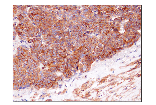 Immunohistochemistry Image 2: Notch2 (D76A6) Rabbit Monoclonal Antibody